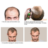 Croissance des cheveux, anti-chute, spray pour la croissance des cheveux, perte de cheveux et traitement des cheveux, pour cheveux clairsemés, favorise une croissance des cheveux plus épaisse, plus complète et plus rapide, 60 ml de soins capillaires Naty Shop