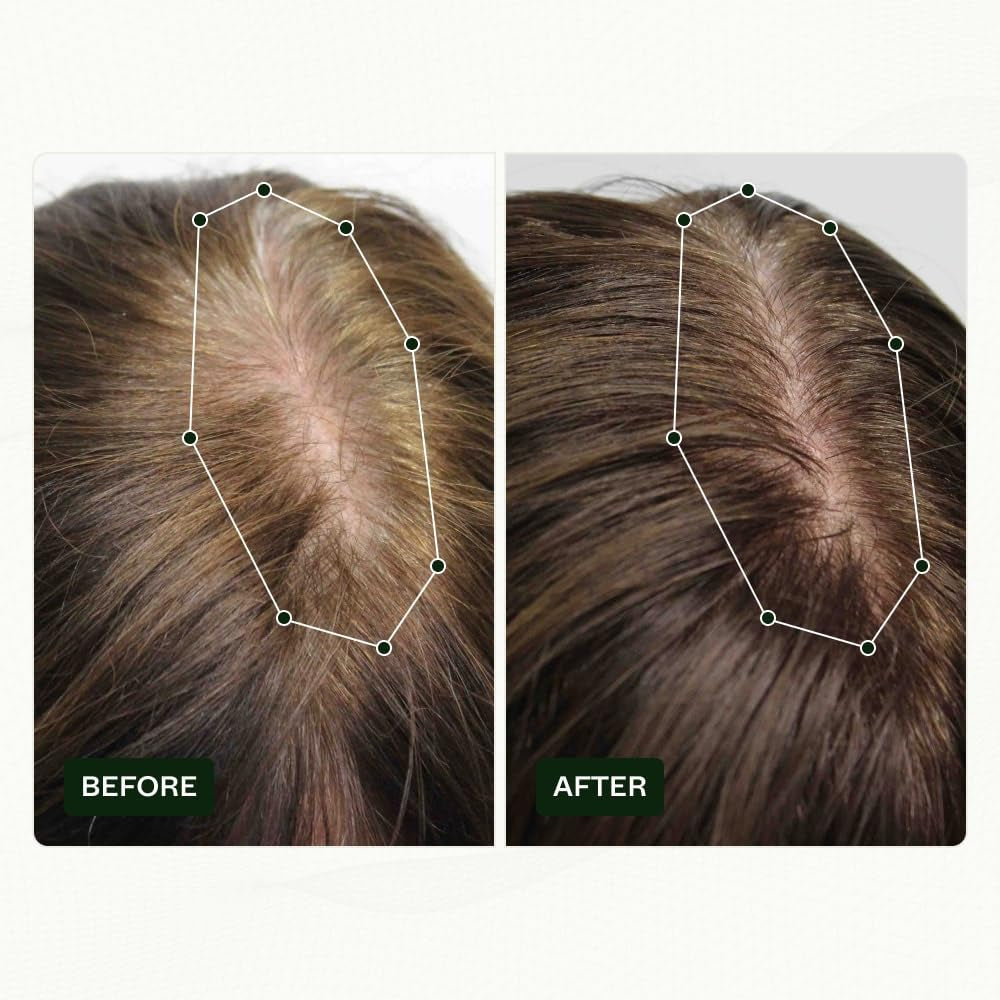 Routine de croissance des cheveux de Norwegian Biolabs pour les femmes avec des résultats cliniquement prouvés en 45 jours | Traitement contre la chute des cheveux (Bio-Pilixin) Naty Shop Soins Capillaires