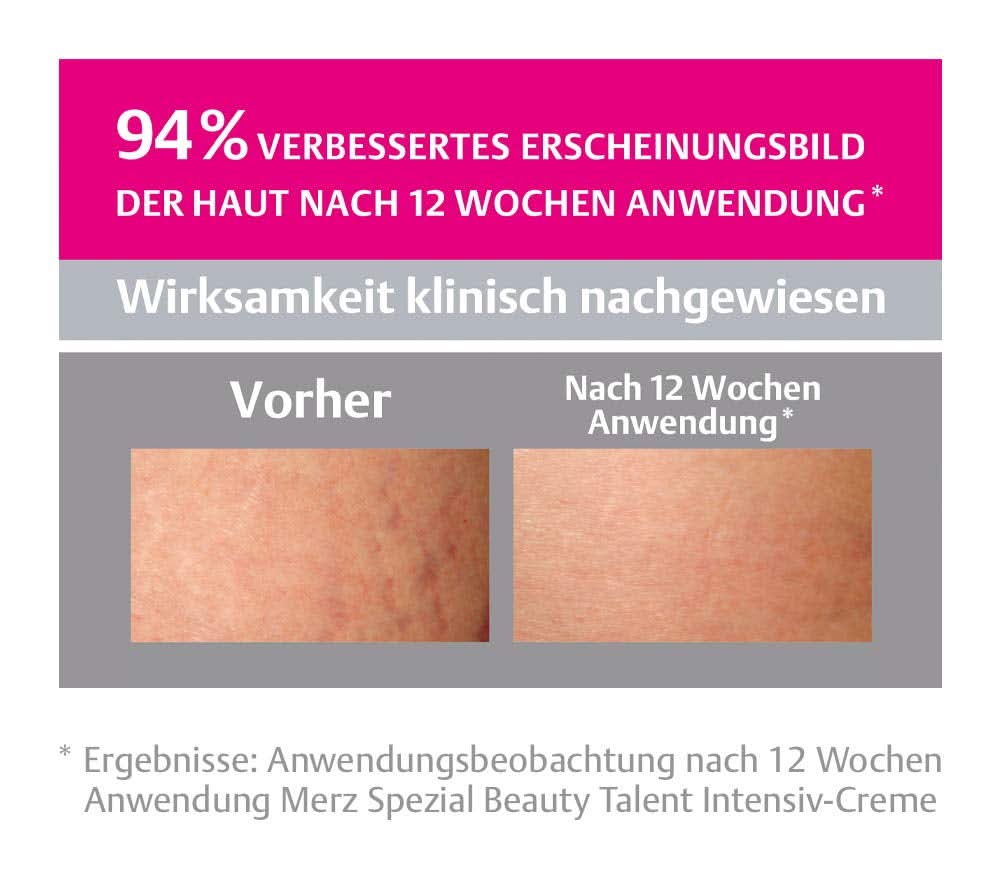 Merz Spezial, Crème intensive contre les vergetures, 75 ml Cosmétiques et Beauté Naty Shop