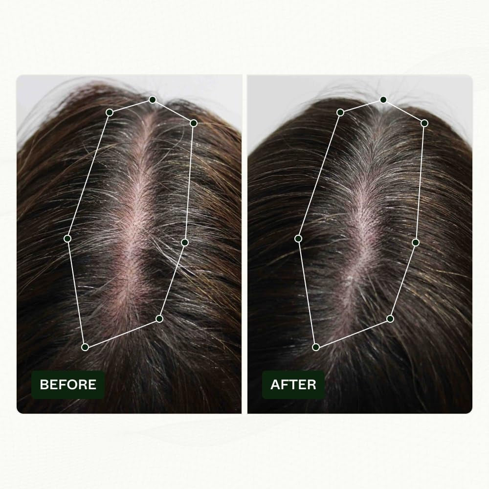 Routine de croissance des cheveux de Norwegian Biolabs pour les femmes avec des résultats cliniquement prouvés en 45 jours | Traitement contre la chute des cheveux (Bio-Pilixin) Naty Shop Soins Capillaires