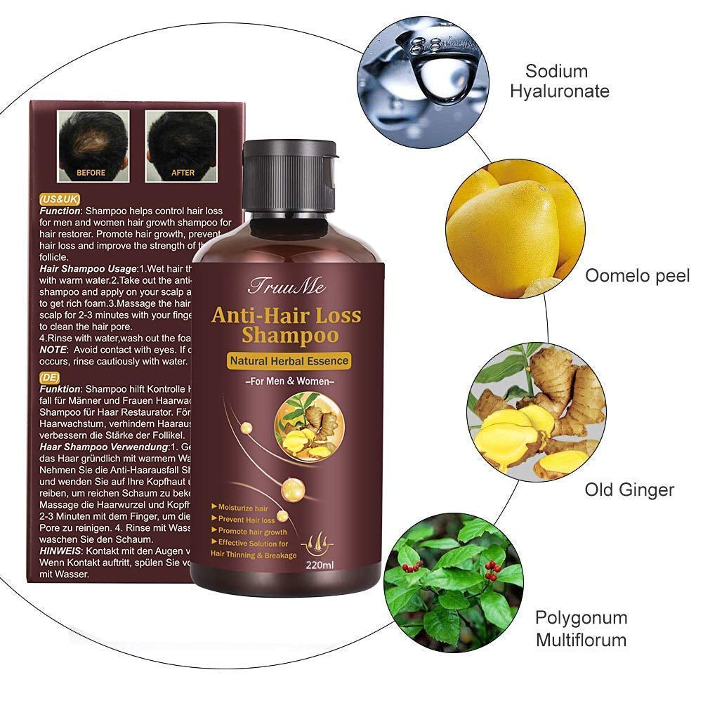 Shampooing pour la croissance des cheveux, anti-chute de cheveux, shampooing contre la perte de cheveux, shampooing naturel à base de plantes pour une croissance plus rapide des cheveux, lotion Naty Shop Hair Care