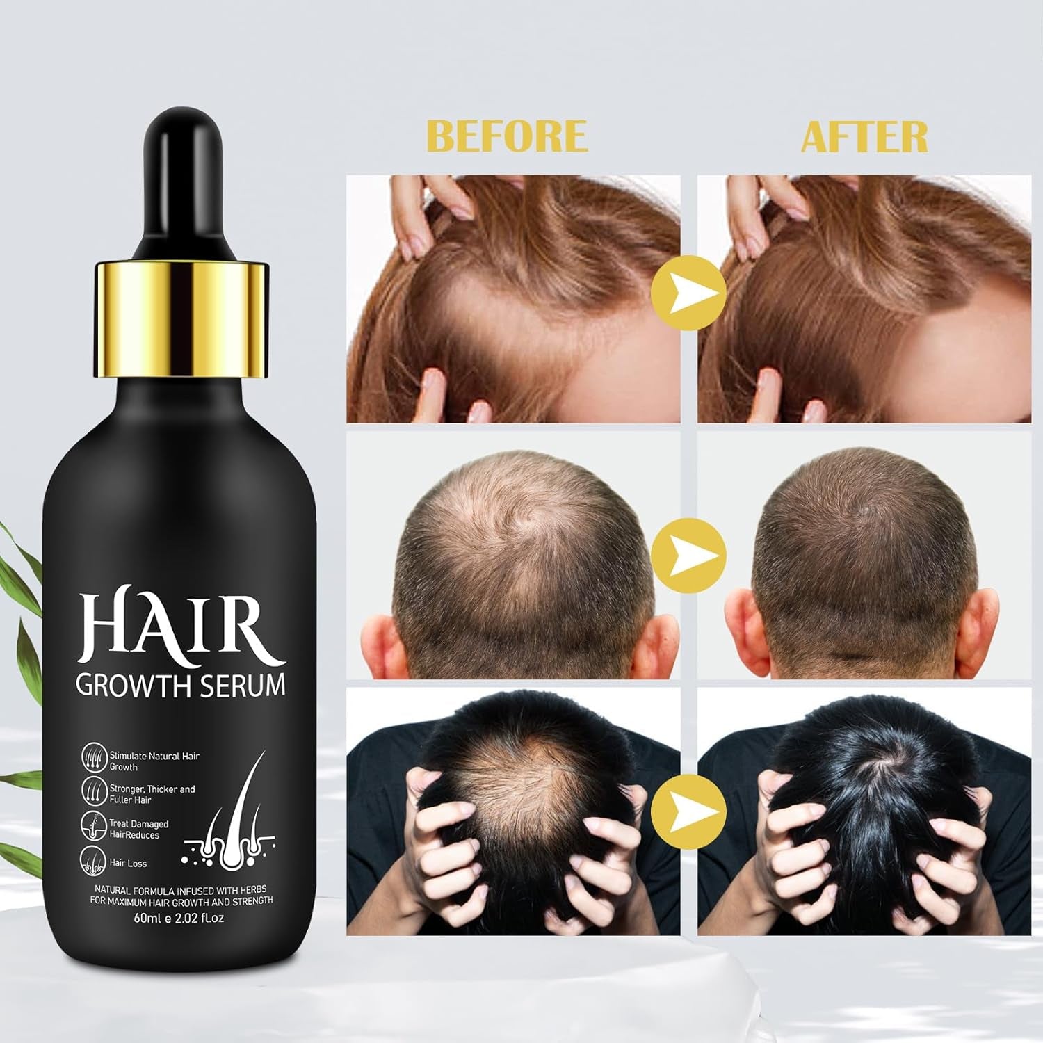 Huile de Croissance Capillaire Bio 5% - Solution Usage Externe - Croissance et Épaississement des Cheveux - Pour Chute de Cheveux Masculine et Cheveux Clairsemés - Réactive les Follicules Rétrécissants - Distributeur à Pompe Précis, 60ml Soin Capillaire Naty Shop
