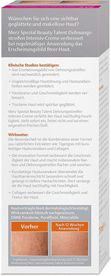 Merz Spezial, Crème intensive contre les vergetures, 75 ml Cosmétiques et Beauté Naty Shop